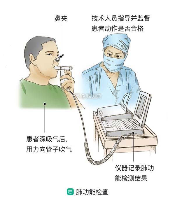 肺功能检查示意图图片