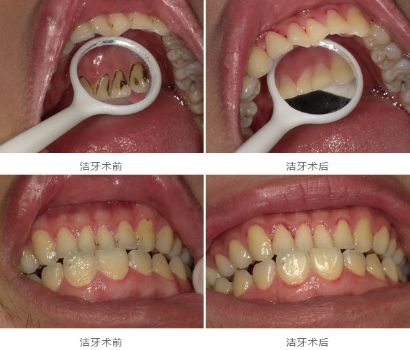 未标题-2.jpg 未标题-2.jpg