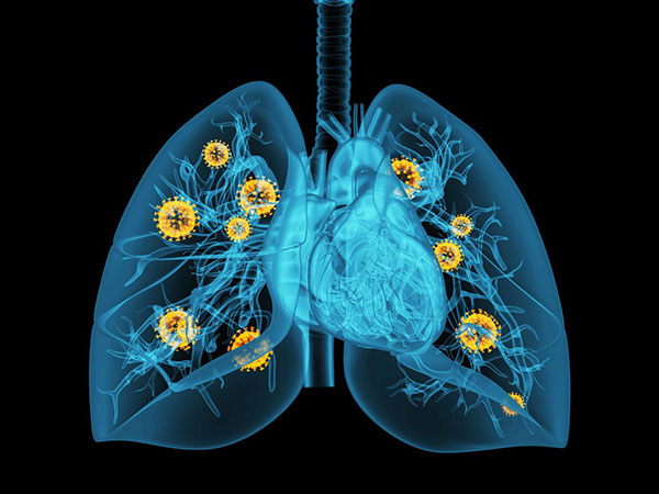 肺癌的分子病理检测
