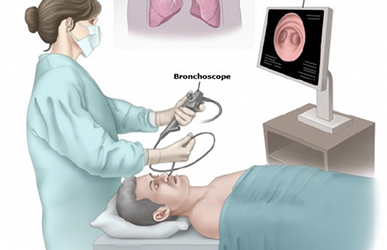 无痛支气管镜检查