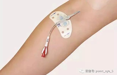 PICC(peripherally inserted central catheters,经外周静脉置入中心静脉导管) 置入术