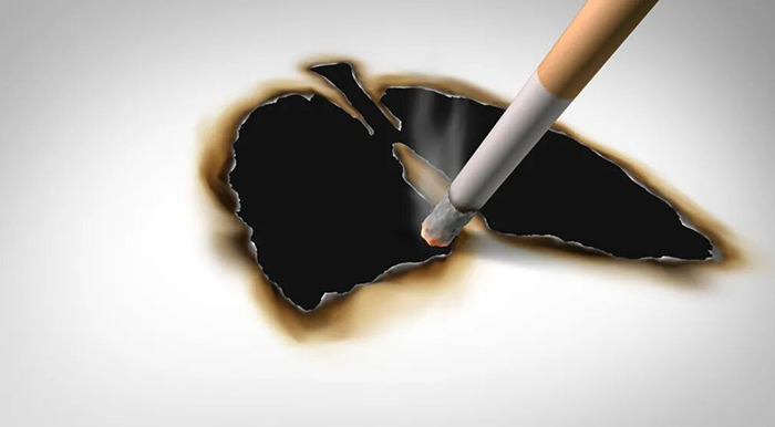 【肺癌诊疗先锋】第二十九期：穿过阴霾，看见光——一位晚期肺癌患者的生命长歌